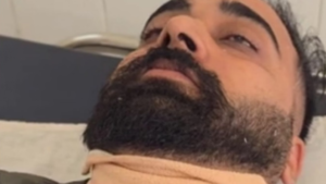 चाइना डोर का कहर: हमले में युवक को लगे 15 टांके |