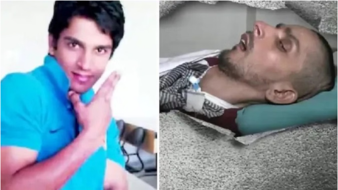 इच्छामृत्यु की प्रक्रिया शुरू: हरीश राणा के लाइफ सपोर्ट के 2 प्रमुख पाइप हटाए गए, हालत पर डॉक्टरों की नजर